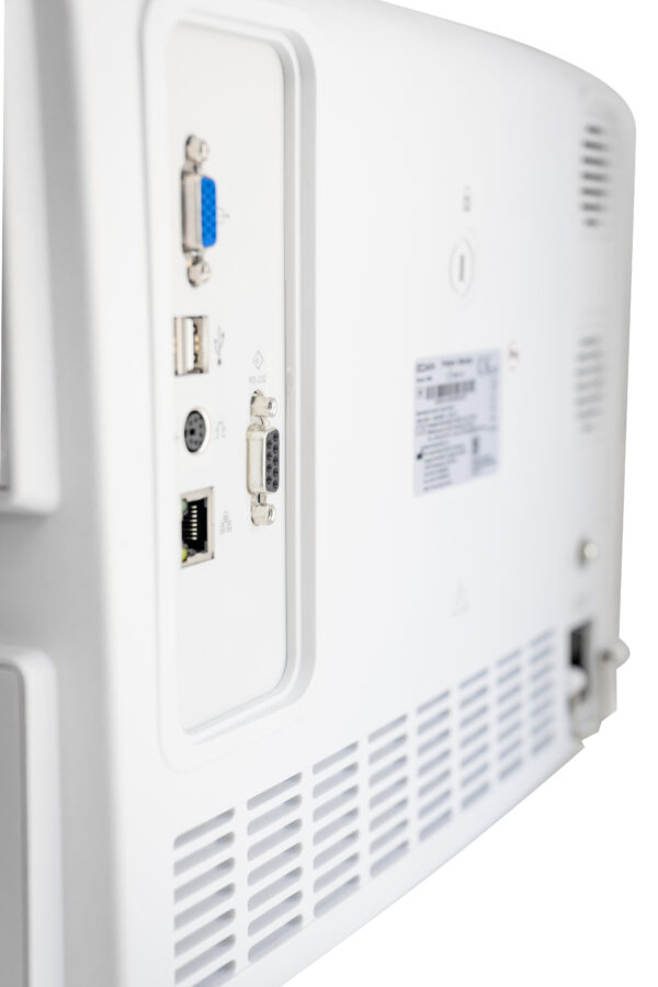 MONITOR DE SIGNOS VITALES IM-80 EDAN - Imagen 4