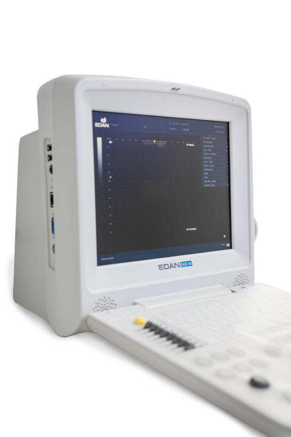 ECOGRAFO PORTATIL PARA HUMANOS EDA DUS-60H